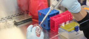 El papel de los medicamentos biosimilares en el cáncer